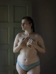 Angela Strassheim, Bruised But Not Broken, 24 x 18 inches